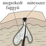 Mitesszer