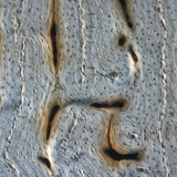 Csont (hosszanti csiszolat)