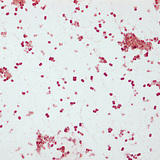 A gonorrhoea kórokozója (Neisseria gonorrhoeae)