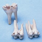 管状磨牙